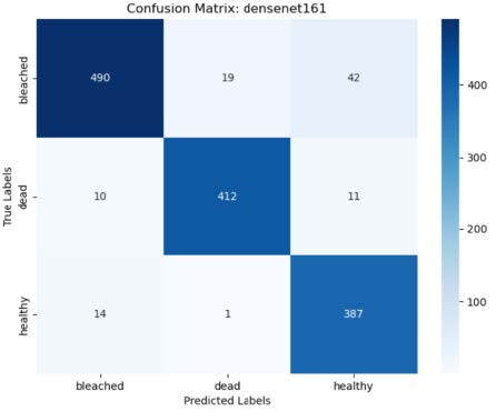 Matrice de confusion du modèle DenseNet2001